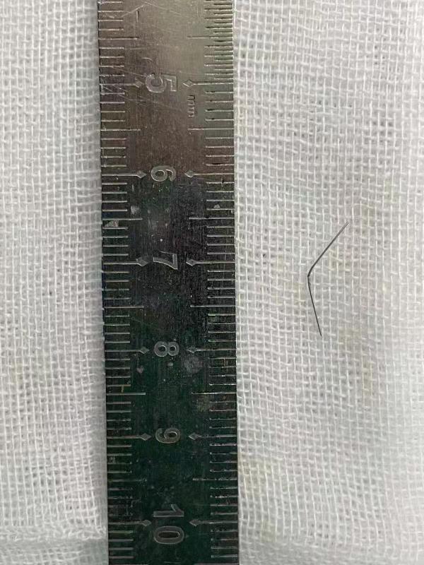 女子注射美容针,女子注射美容针后续