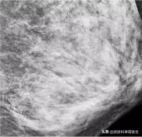 美容院的乳房按摩靠谱吗,美容院乳房保养靠谱吗