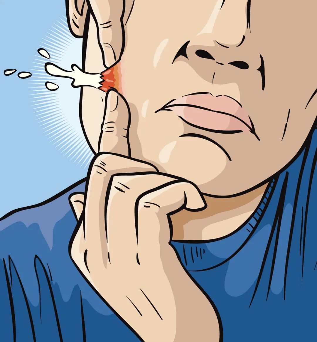 为什么面部会长痘痘别的地方不长,脸上长痘痘身上也有痘痘咋回事