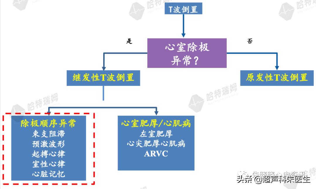 t波倒置9个真相图解,t波倒置判断口诀
