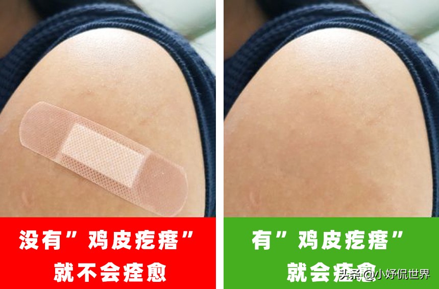 冷知识9个有趣,冷知识鸡皮疙瘩