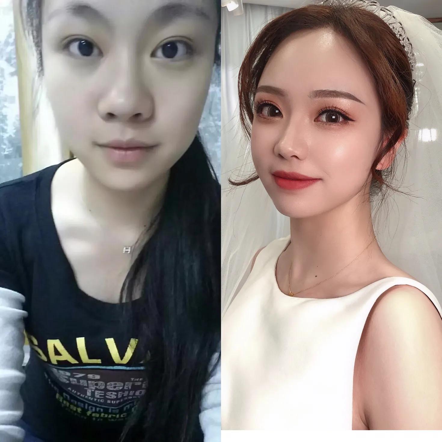 高鼻梁养成记✌️你不得不知道的变美秘密