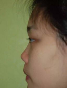 朝天鼻女明星图片,塌鼻好看的明星