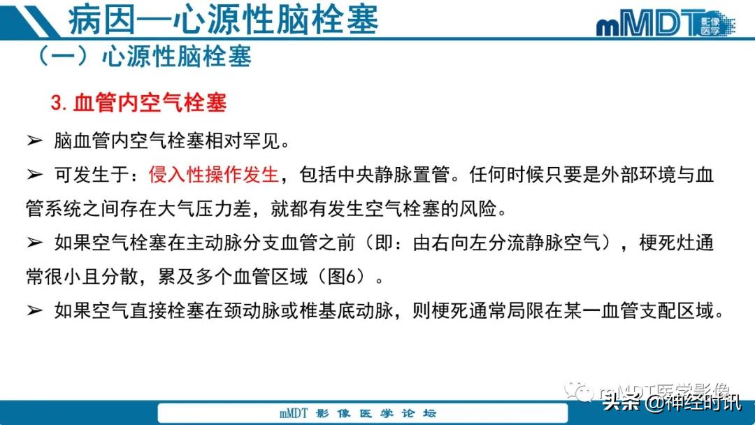 缺血性脑卒中护理课件,缺血性脑卒中讲课ppt