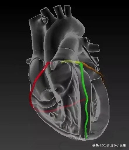 跟陈大夫学看冠脉，看一下人体的冠脉是怎么样的