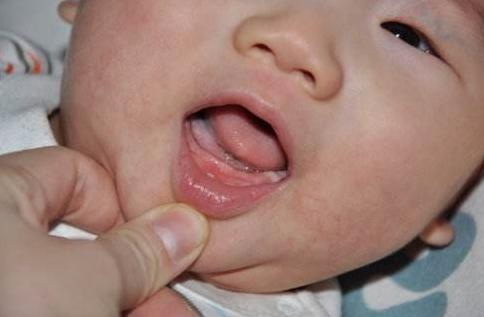 9个月宝宝没出牙不吃奶,9个月纯母乳宝宝没长牙