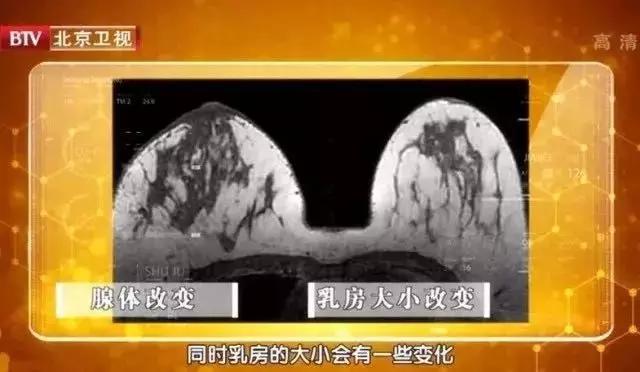 腋下有多余的赘肉怎么办,腋下副乳越来越大什么原因