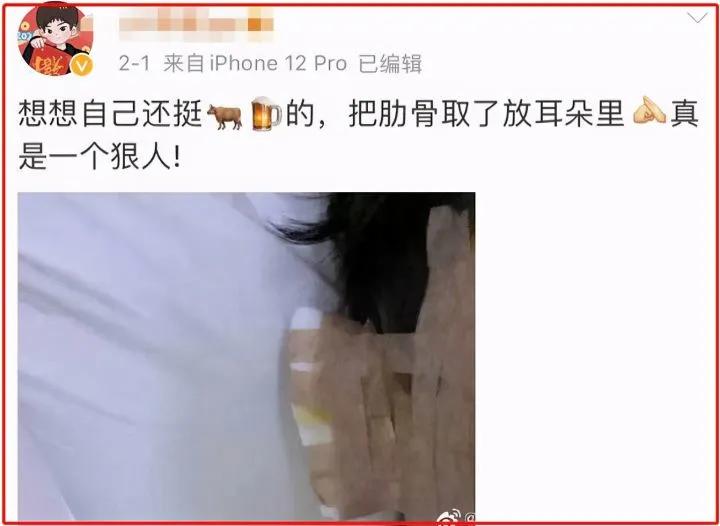 小腿阻断针,小腿阻断