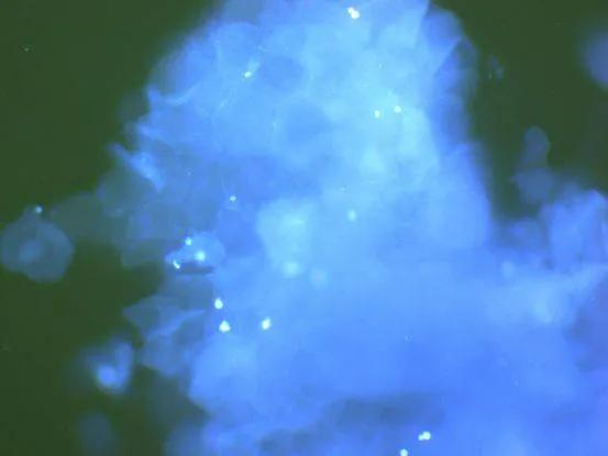 猫癣怎么预防和治疗,10年的老猫怎么照顾