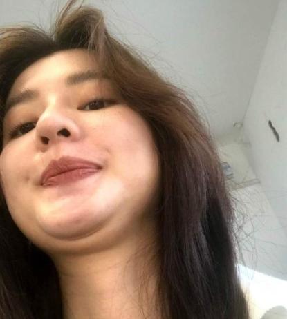 脸大还有双下巴怎么减最有效,胖导致的双下巴怎么解决