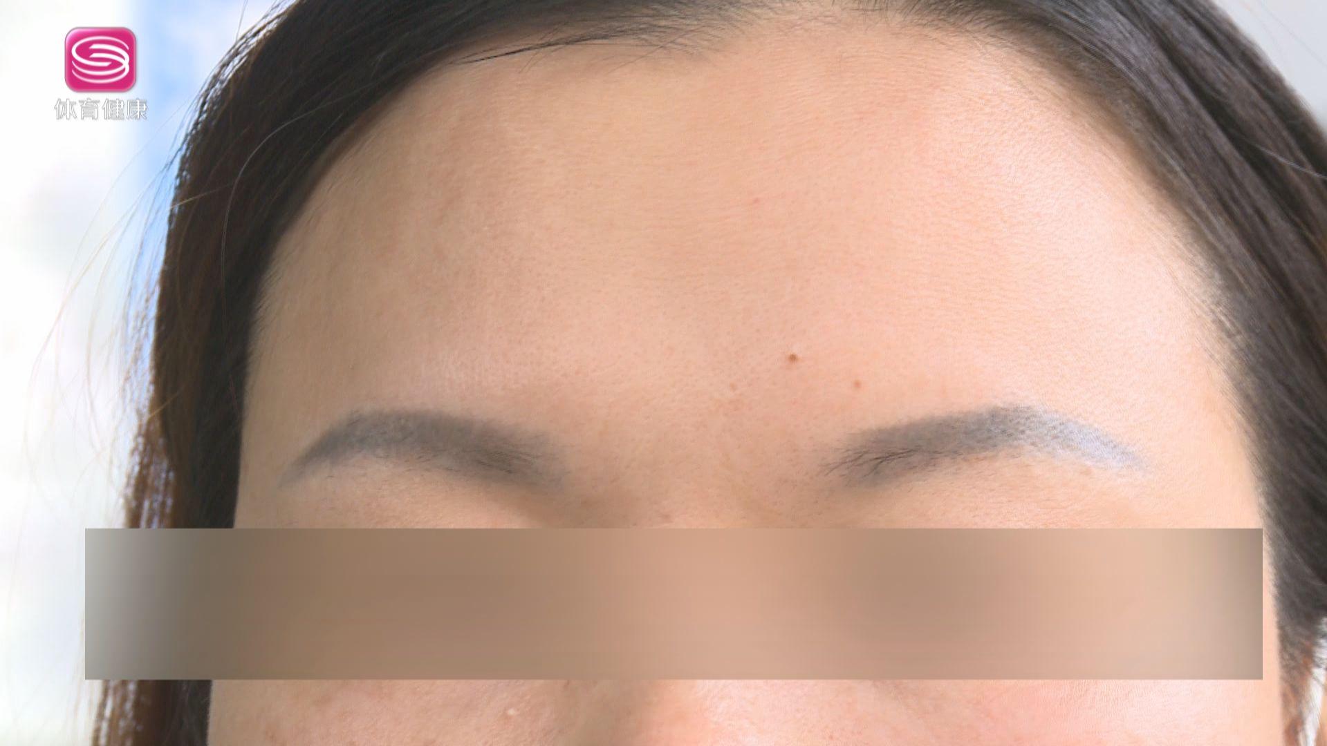 3分钟淡化法令纹你一定能学会,法令纹重非医美手段怎么改善