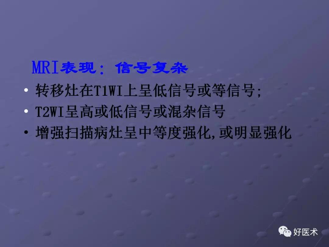 脊柱mri有哪些特点,乳腺疾病的mri诊断及鉴别