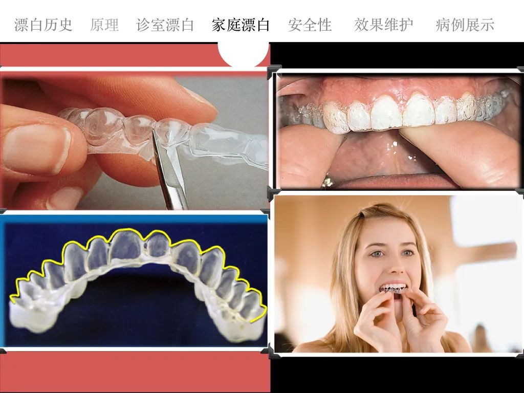 牙医从业感悟,牙医忠告11条