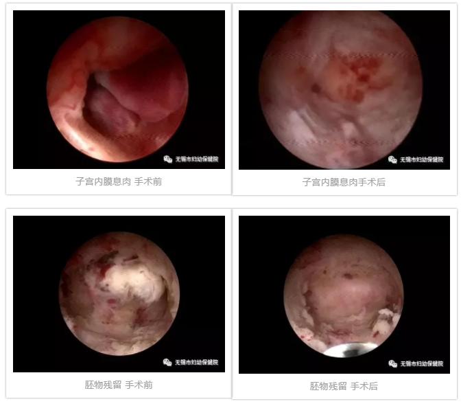 妇幼保健院宫腔镜哪个医生好,关于妇幼的新闻