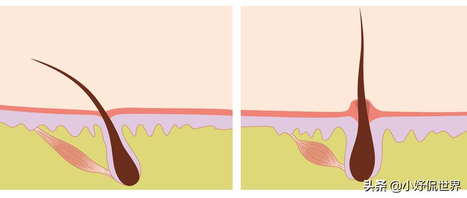 冷知识9个有趣,冷知识鸡皮疙瘩