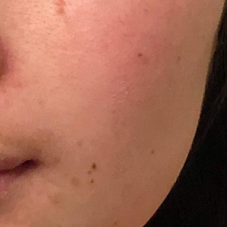 科颜氏抗初老精华露元气弹,科颜氏小白瓶跟元气弹