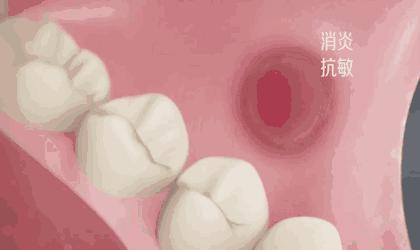 李佳琦给高晓松涂了口红，“美”得不像话？！不过牙齿是真的白