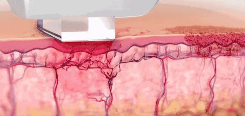 #安心变美课堂##我的安心变美推荐#美白，原来这也有满分操作