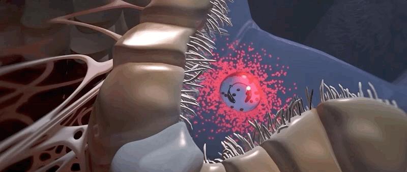 哮喘过敏症的症状,呼吸道过敏哮喘症状