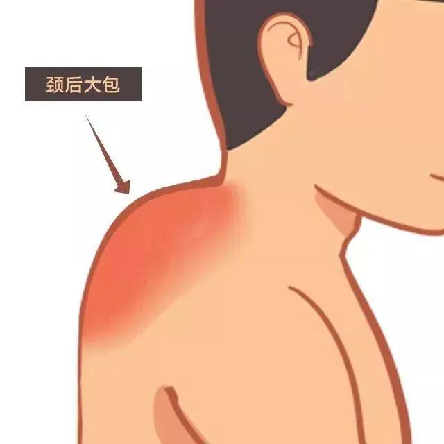 拒绝富贵包动作,拒绝富贵包的姿势