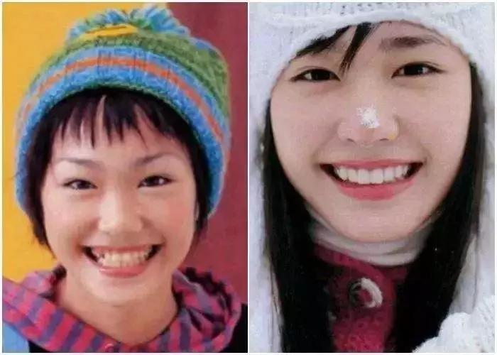 岛国人民竟然流行“八重齿”！*牙虎**真的可爱吗？