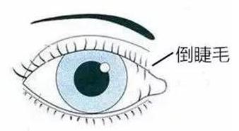 孩子频繁眨眼眼睛往上翻,孩子频繁眨眼是怎么回事