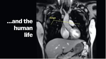 为了研究人类*行为性**，科学家利用核磁成像技术拍下了整个过程