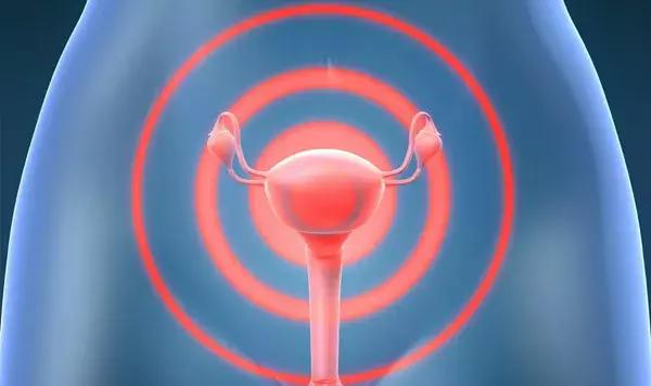 卵巢早衰，人易老！这5种表现都在告诉你：不保护就老了