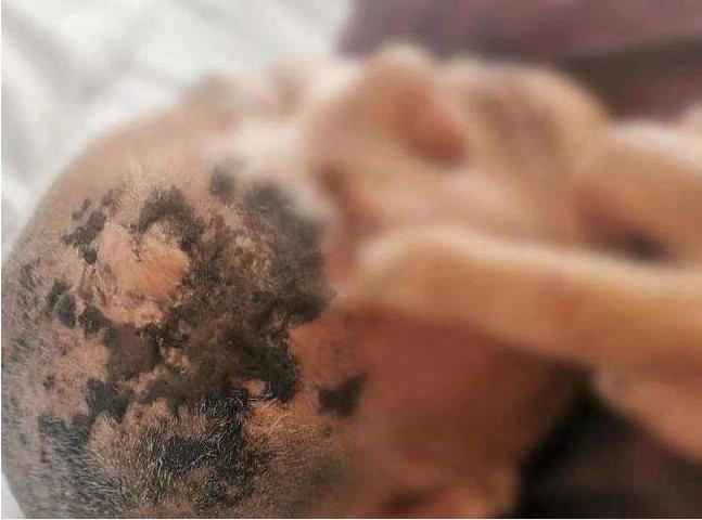 老太太为治病信偏方,剃光头发满脸涂墨汁!这病疼起来堪比生娃