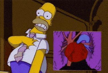 心脏病的真实原因，心脏病和炎症的关系……