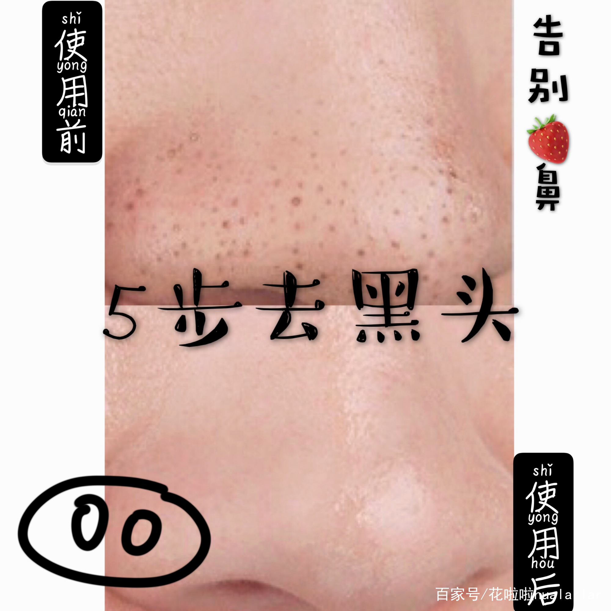 好物种草丨去黑头组合拳，荷荷巴油搭配这款神器，效果才是真好