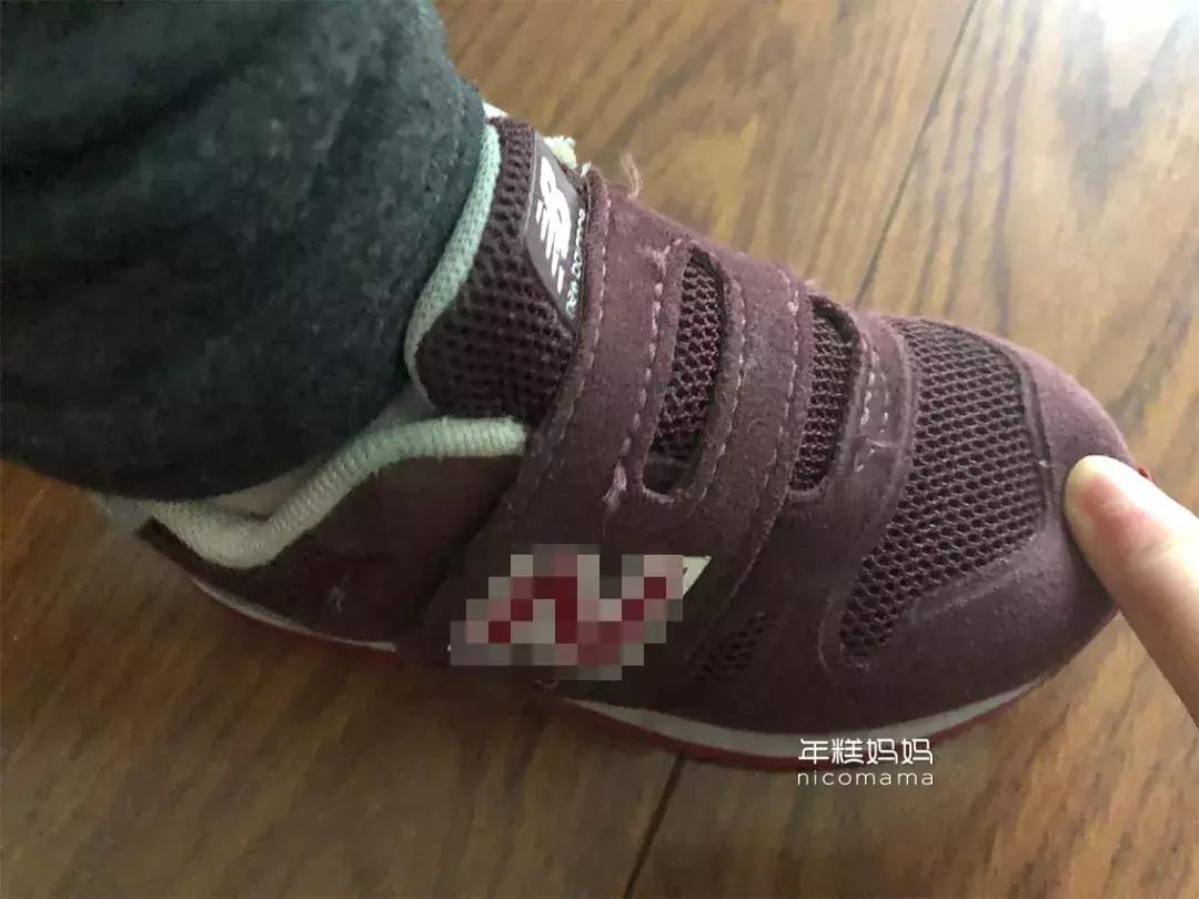 如何给宝宝正确选鞋,宝宝选鞋子的技巧