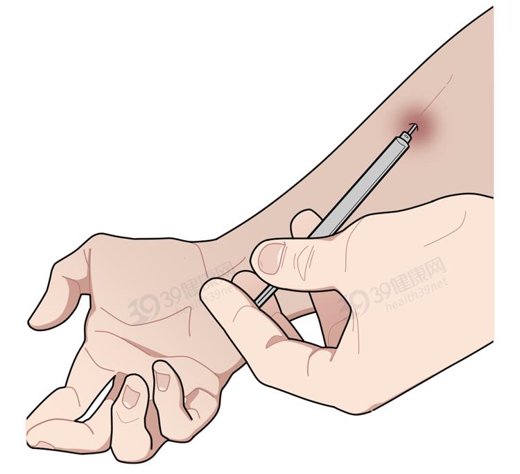 判断吸毒最简单的办法,吸毒早期的5个特征