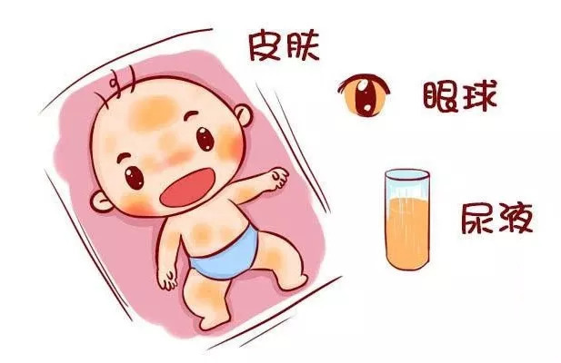 肝胆湿热引起胆红素升高吃什么药,长期吃药引起总胆红素偏高怎么办