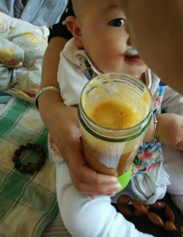 孩子被查出肾衰竭原来因吃盐太多,10个月宝宝肾衰竭怎么办