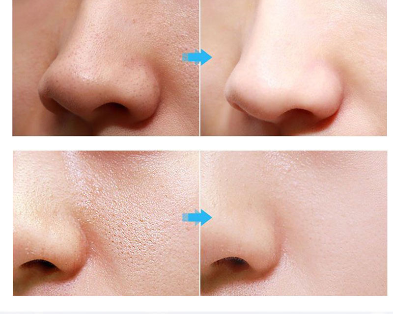 肌底液和精华液原液有什么区别,原液精油精华液肌底液傻傻分不清