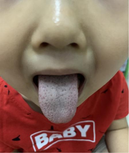 熬夜后盗汗鼻出血,一个月之内盗汗好几次是怎么回事