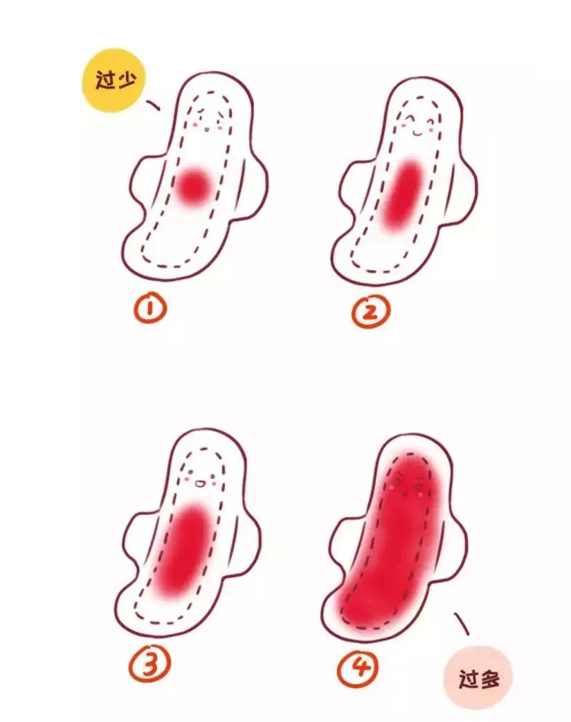 宫寒会导致哪些疾病,宫寒的女孩子容不容易怀孕