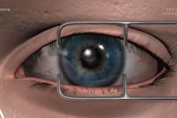 医生手术后最想做什么,医生做完手术以后会怎样