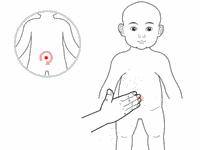 宝宝厌食最快的解决方法,为什么宝宝会厌食偏食