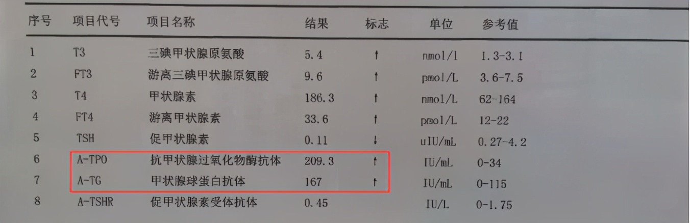 出汗很多手抖心慌看什么科,出汗手抖看什么科