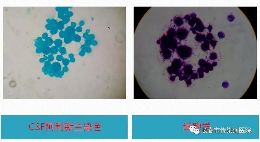 救命的3小时，惠民利民的“脑（膜）炎一站式快速诊断平台”望在全省逐步开展