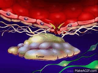 结直肠癌化疗联合西妥昔单抗,直肠癌靶向药和化疗哪种效果好