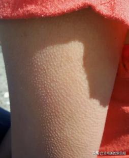 鸡皮肤怎么变白变嫩,如何去除鸡皮肤小窍门图解