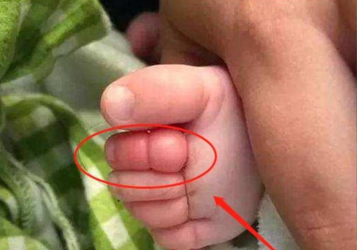 “妈妈，我的脚进虫子了”，宝妈赶紧上医院，医生：还好来得早