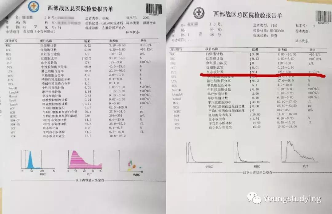 多学科合作精准定位下冲击波联合PRP治疗骨折延迟愈合/骨不连