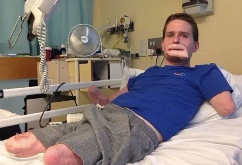 紧急！全澳多地出现“吃人菌”，感染后如同丧尸！24小时可吃一人