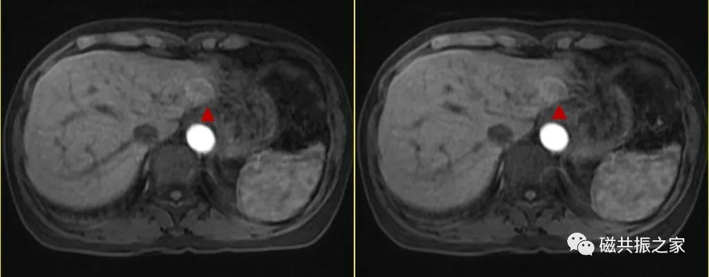 mri知识,mri讲解科普