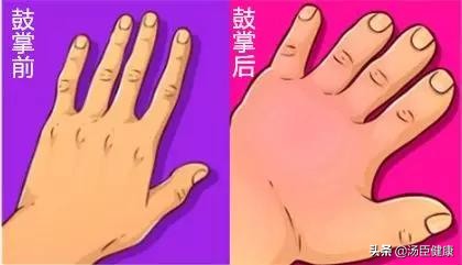 上了个厕所黄体破裂,疑似黄体破裂下体一直在出血