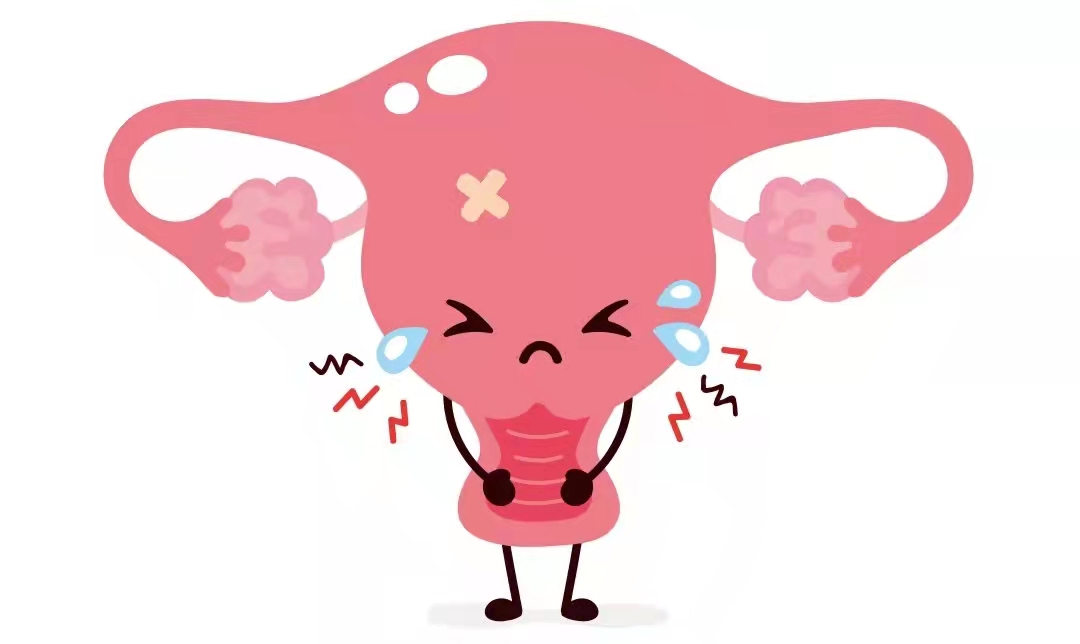 子宫肌瘤有没有不开刀的治疗方法,子宫肌瘤不想切除就想消融